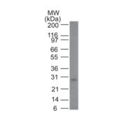 Western Blot: Human skin lysate, 10ug. Using Mouse monoclonal Bcl-2 [Clone 100/D5 + 124] antibody at 1:500.